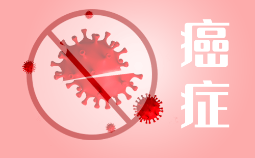 放射治疗有什么特点呢？放疗的优势是什么？